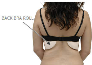 back bra roll